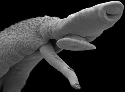 Parasitorganismus